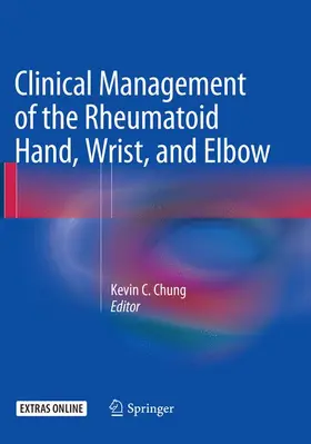 Chung |  Clinical Management of the Rheumatoid Hand, Wrist, and Elbow | Buch |  Sack Fachmedien