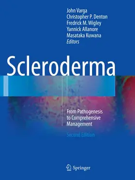 Varga / Denton / Kuwana |  Scleroderma | Buch |  Sack Fachmedien