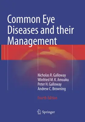 Galloway / Amoaku / Browning |  Common Eye Diseases and their Management | Buch |  Sack Fachmedien