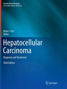 Carr |  Hepatocellular Carcinoma | Buch |  Sack Fachmedien