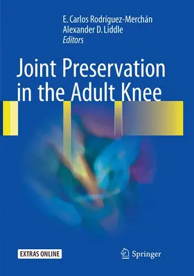 Liddle / Rodríguez-Merchán |  Joint Preservation in the Adult Knee | Buch |  Sack Fachmedien