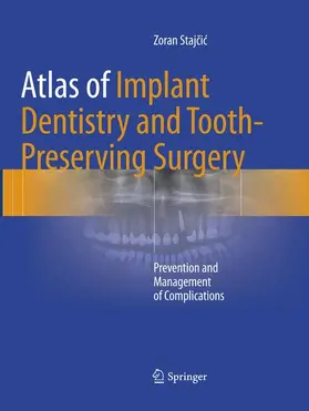 Stajcic / Stajcic |  Atlas of Implant Dentistry and Tooth-Preserving Surgery | Buch |  Sack Fachmedien