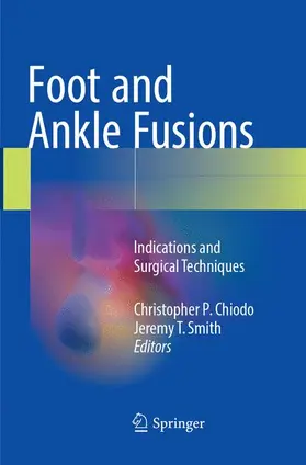 Smith / Chiodo |  Foot and Ankle Fusions | Buch |  Sack Fachmedien