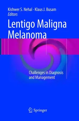 Busam / Nehal |  Lentigo Maligna Melanoma | Buch |  Sack Fachmedien