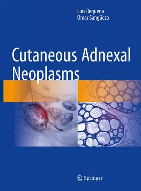 Sangüeza / Requena |  Cutaneous Adnexal Neoplasms | Buch |  Sack Fachmedien