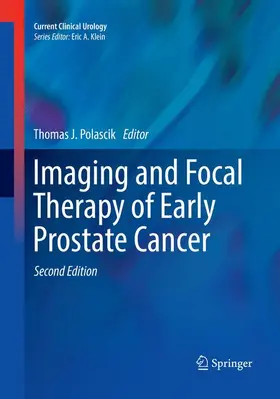 Polascik |  Imaging and Focal Therapy of Early Prostate Cancer | Buch |  Sack Fachmedien