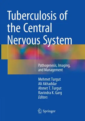 Turgut / Garg / Akhaddar |  Tuberculosis of the Central Nervous System | Buch |  Sack Fachmedien