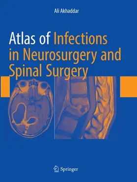 Akhaddar |  Atlas of Infections in Neurosurgery and Spinal Surgery | Buch |  Sack Fachmedien