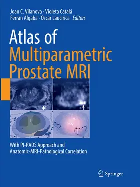Vilanova / Catalá / Algaba |  Atlas of Multiparametric Prostate MRI | Buch |  Sack Fachmedien