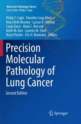 Cagle / Dacic / Allen |  Precision Molecular Pathology of Lung Cancer | Buch |  Sack Fachmedien