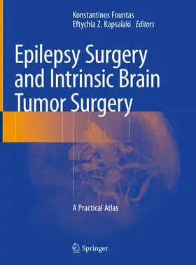 Fountas / Kapsalaki | Epilepsy Surgery and Intrinsic Brain Tumor Surgery | E-Book | sack.de