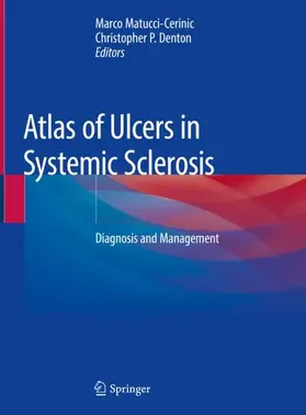 Denton / Matucci-Cerinic |  Atlas of Ulcers in Systemic Sclerosis | Buch |  Sack Fachmedien