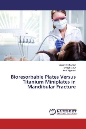 Kumar / Gour / Agarwal |  Bioresorbable Plates Versus Titanium Miniplates in Mandibular Fracture | Buch |  Sack Fachmedien
