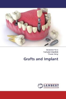 Rana / Chandhok / Dangi |  Grafts and Implant | Buch |  Sack Fachmedien