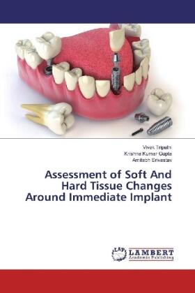 Tripathi / Gupta / Srivastav |  Assessment of Soft And Hard Tissue Changes Around Immediate Implant | Buch |  Sack Fachmedien