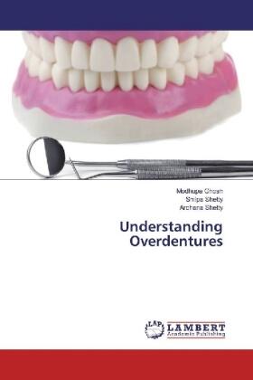 Ghosh / Shetty |  Understanding Overdentures | Buch |  Sack Fachmedien
