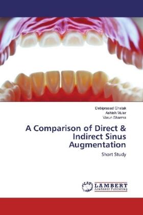 Ghatak / Mular / Sharma |  A Comparison of Direct & Indirect Sinus Augmentation | Buch |  Sack Fachmedien