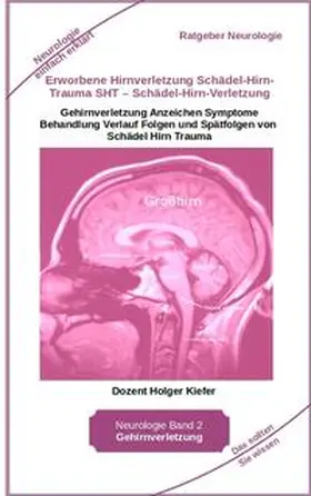 Kiefer |  Erworbene Hirnverletzung Schädel-Hirn-Trauma SHT - Schädel-Hirn-Verletzung - Rehabilitation - für Patienten, Angehörige, medizinisches Personal | Buch |  Sack Fachmedien