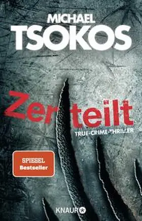 Tsokos |  Zerteilt | Buch |  Sack Fachmedien