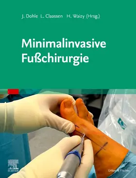 Dohle / Claaßen / Waizy |  Minimalinvasive Fußchirurgie | Buch |  Sack Fachmedien