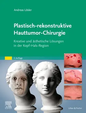 Lösler |  Plastisch-rekonstruktive Hauttumor-Chirurgie | Buch |  Sack Fachmedien