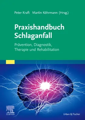 Kraft / Köhrmann |  Praxishandbuch Schlaganfall | Buch |  Sack Fachmedien