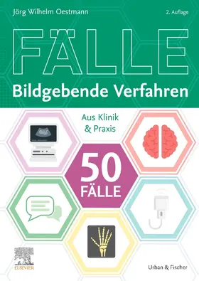 Oestmann |  Die 50 wichtigsten Fälle Bildgebende Verfahren | Buch |  Sack Fachmedien