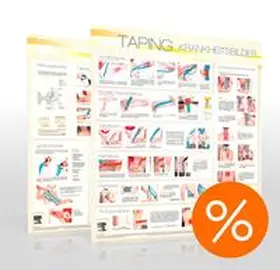 Ilbeygui |  Taping Wandtafeln - Techniken und Krankheitsbilder | Sonstiges |  Sack Fachmedien