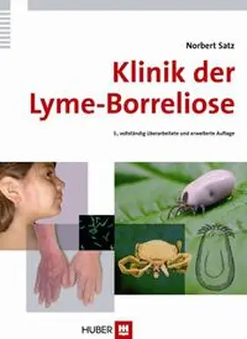 Satz |  Klinik der Lyme-Borreliose | Buch |  Sack Fachmedien