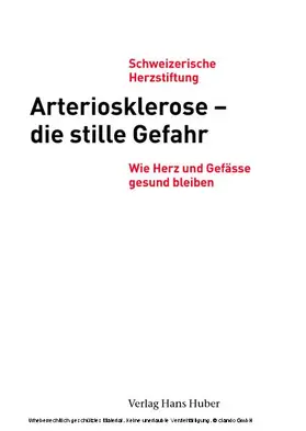 Döring |  Arteriosklerose – die stille Gefahr | eBook | Sack Fachmedien