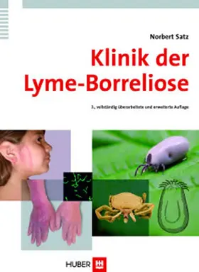 Satz |  Klinik der Lyme-Borreliose | eBook | Sack Fachmedien