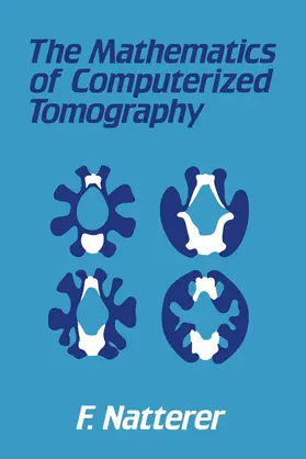 Natterer |  The Mathematics of Computerized Tomography | Buch |  Sack Fachmedien