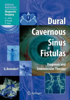 Benndorf | Dural Cavernous Sinus Fistulas | Buch | 978-3-540-00818-7 | sack.de