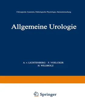 Lichtenberg / Voelcker / Wildbolz |  Allgemeine Urologie | Buch |  Sack Fachmedien