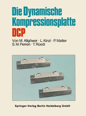 Allgöwer / Kinzl / Rüedi |  Die Dynamische Kompressionsplatte DCP | Buch |  Sack Fachmedien