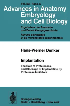 Denker |  Implantation | Buch |  Sack Fachmedien
