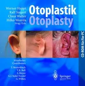 Heppt / Siegert / Walter |  Otoplastik/Otoplasty | Sonstiges |  Sack Fachmedien