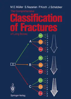 Müller / Nazarian / Koch |  The Comprehensive Classification of Fractures of Long Bones | Buch |  Sack Fachmedien