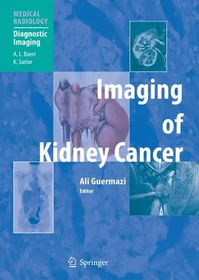 Guermazi | Imaging of Kidney Cancer | Buch | 978-3-540-21129-7 | sack.de