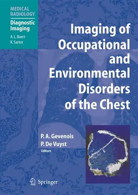 Gevenois / de Vuyst |  Imaging of Occupational and Environmental Disorders of the Chest | Buch |  Sack Fachmedien