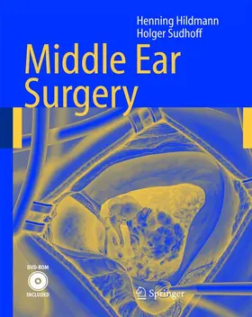 Sudhoff / Hildmann |  Middle Ear Surgery | Buch |  Sack Fachmedien