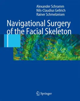 Schramm / Schmelzeisen / Gellrich |  Navigational Surgery of the Facial Skeleton | Buch |  Sack Fachmedien