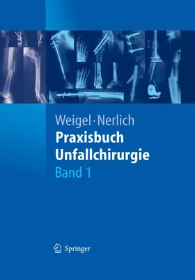Weigel / Nerlich |  Praxisbuch Unfallchirurgie | eBook | Sack Fachmedien