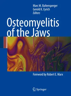 Baltensperger / Eyrich |  Osteomyelitis of the Jaws | eBook | Sack Fachmedien