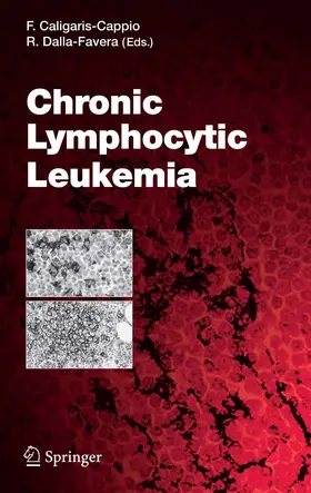 Caligaris-Cappio | Chronic Lymphocytic Leukemia | E-Book | sack.de