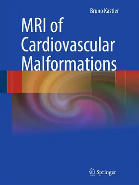 Kastler |  MRI of Cardiovascular Malformations | Buch |  Sack Fachmedien