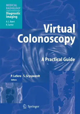 Lefere / Gryspeerdt |  Virtual Colonoscopy | eBook | Sack Fachmedien