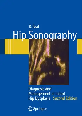 Graf |  Hip Sonography | eBook | Sack Fachmedien