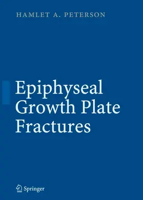 Peterson | Epiphyseal Growth Plate Fractures | E-Book | www2.sack.de
