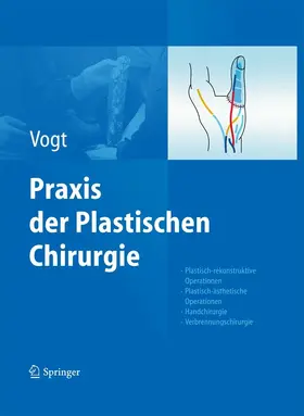 Vogt | Praxis der Plastischen Chirurgie | E-Book | sack.de